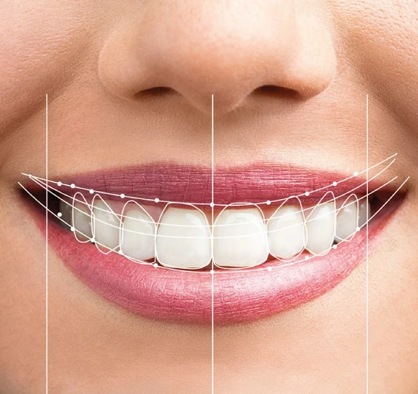 盲點三: 標準的黃金比例牙齒是最好?張智洋醫師-全方位植牙美學權威