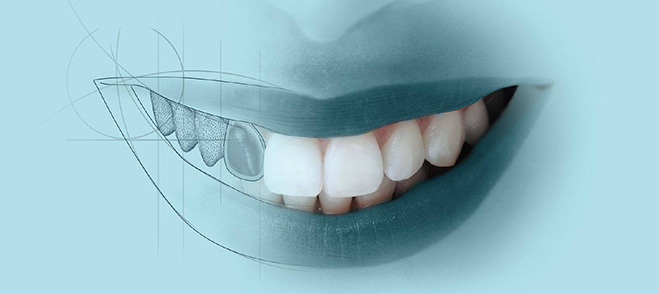 美容牙科 Cosmetic Dentistry - 全方位牙齒美學權威 張智洋醫師