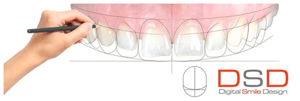 數位微笑設計DSD - 全方位牙齒美學權威 張智洋醫師
