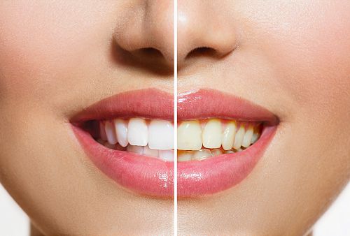【飛利浦】破解DIY美白牙齒偏方！牙齒健康自然白 | 張智洋醫師