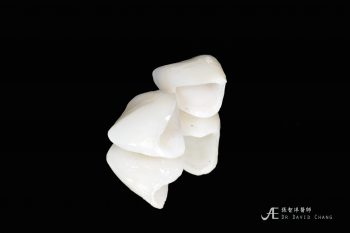 全瓷冠製作過程,展現自然透光性