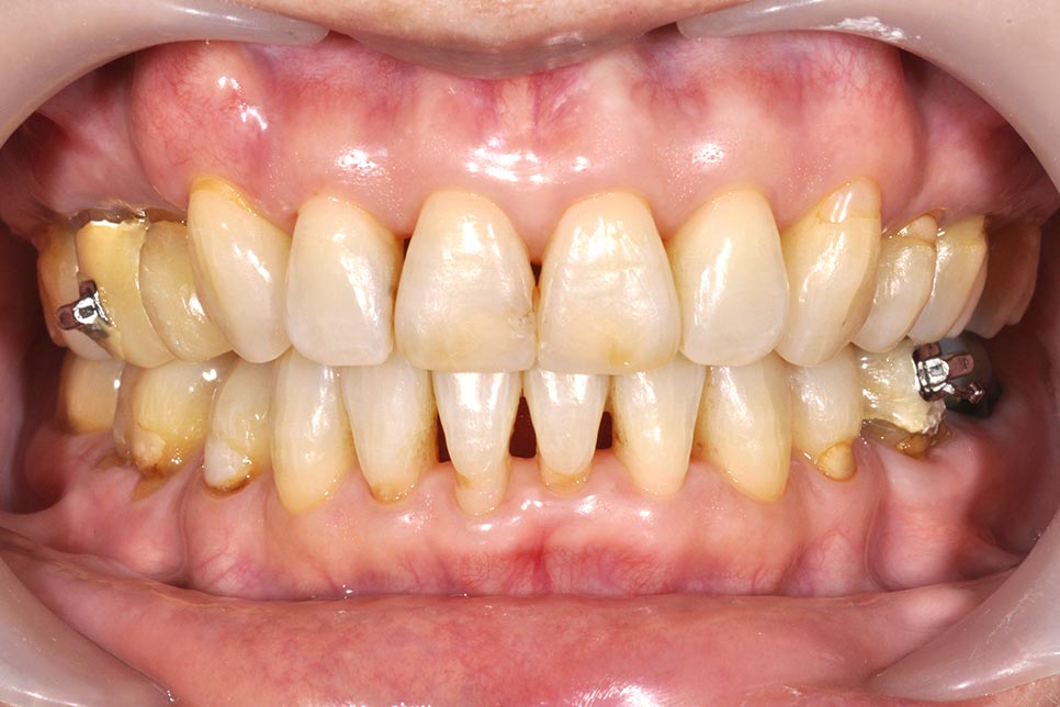 _DSC0028b-美容牙科-全方位牙齒美學權威-張智洋醫師
