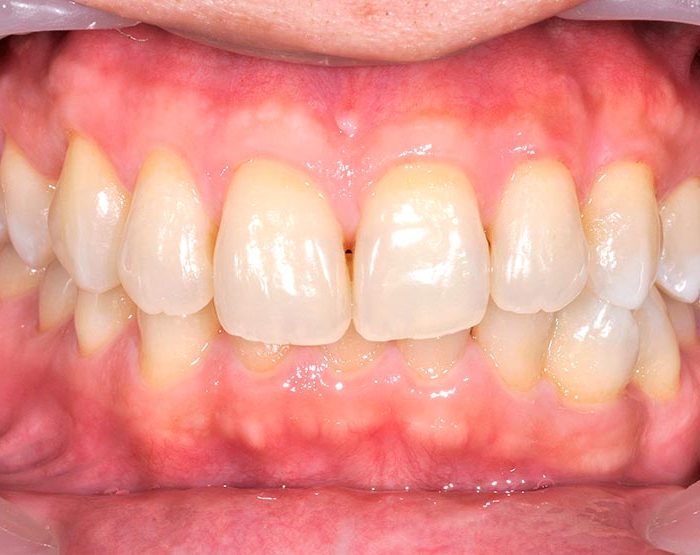 _DSC1081 牙齒美白案例四f 美白後 -全方位牙齒美學權威 張智洋醫師