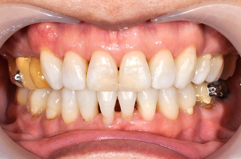 _DSC9894b-美容牙科-全方位牙齒美學權威-張智洋醫師