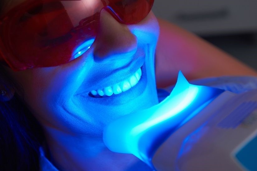 What-Is-Teeth-Whitening-美容牙科-全方位牙齒美學權威-張智洋醫師 (2)