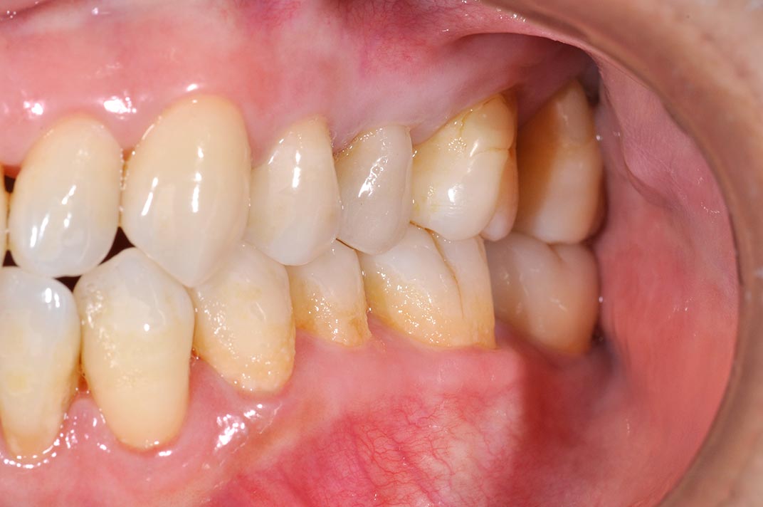 _DSC1258-3D齒雕-全方位牙齒美學權威-張智洋醫師