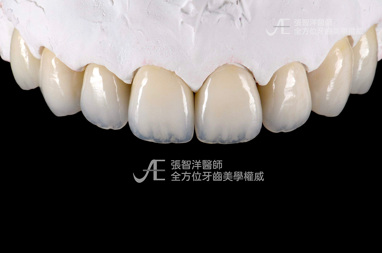 IMG_8438-張智洋醫師-全方位植牙美學權威