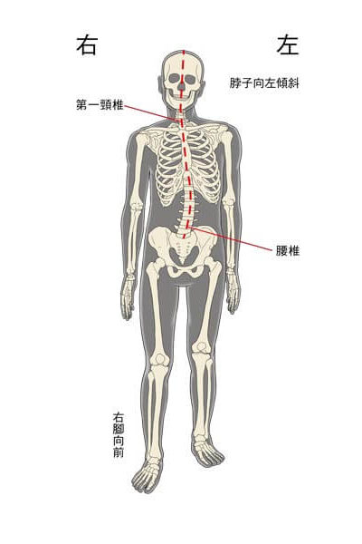 顳顎關節出現偏移時，身體會出現何種反應 small-顳顎關節症候群Neuromuscular Disorder-張智洋醫師-全方位植牙美學權威(1)